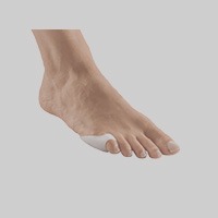 foot pain treatment in dubai