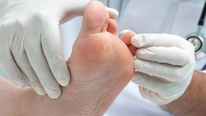 What is diabetic foot wound dressing?