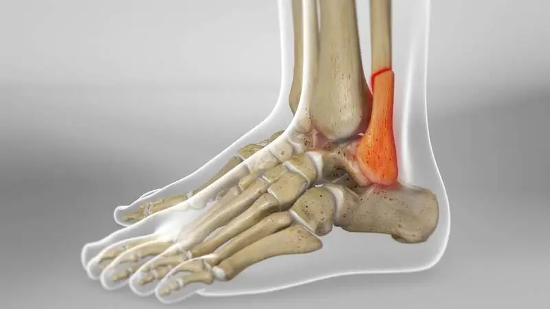 How does a doctor diagnose ankle instability?