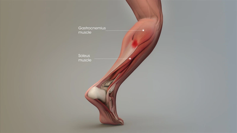 Leg and Pelvic Tendons