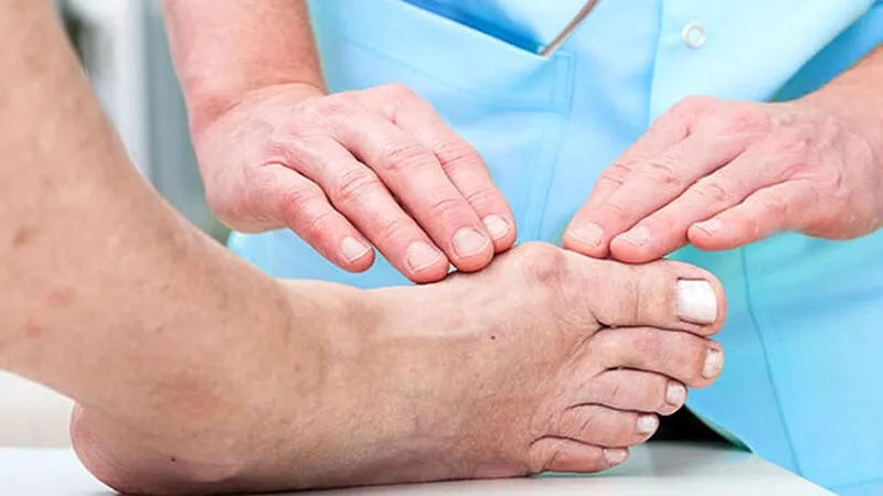 New methods of bunion deformity surgery