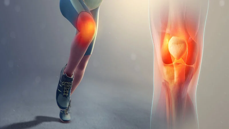 Sports injuries related to the knee