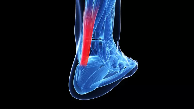 What Is a Tendon Injury?