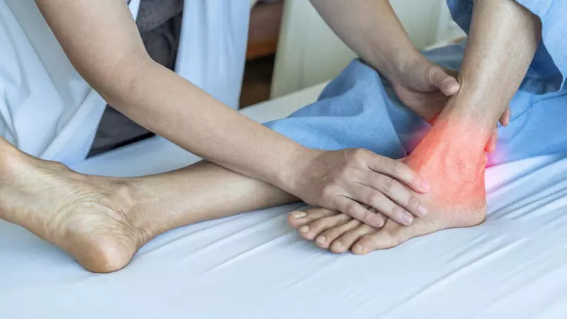 What Is a Tendon Rupture?