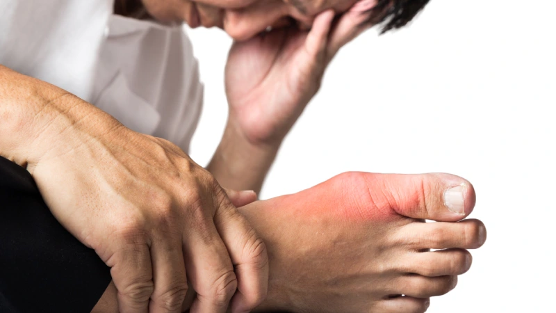 What are the symptoms of gout?