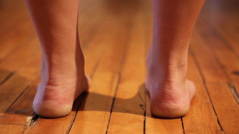 What does flat feet mean?