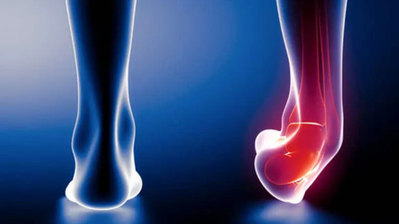 What factors increase the risk of ankle instability?