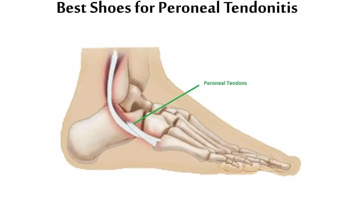 What is the peroneal tendon?