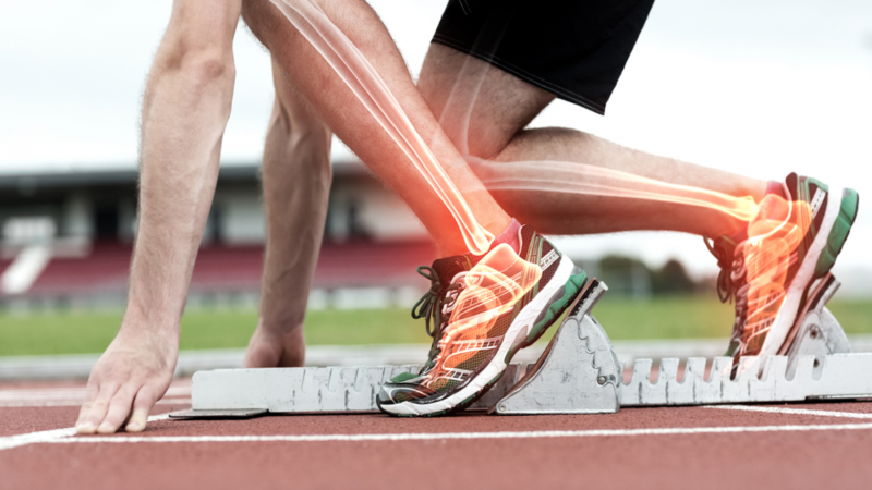What should be done if sports injuries are severe?