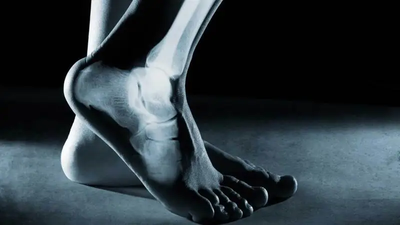 Why does ankle instability occur?